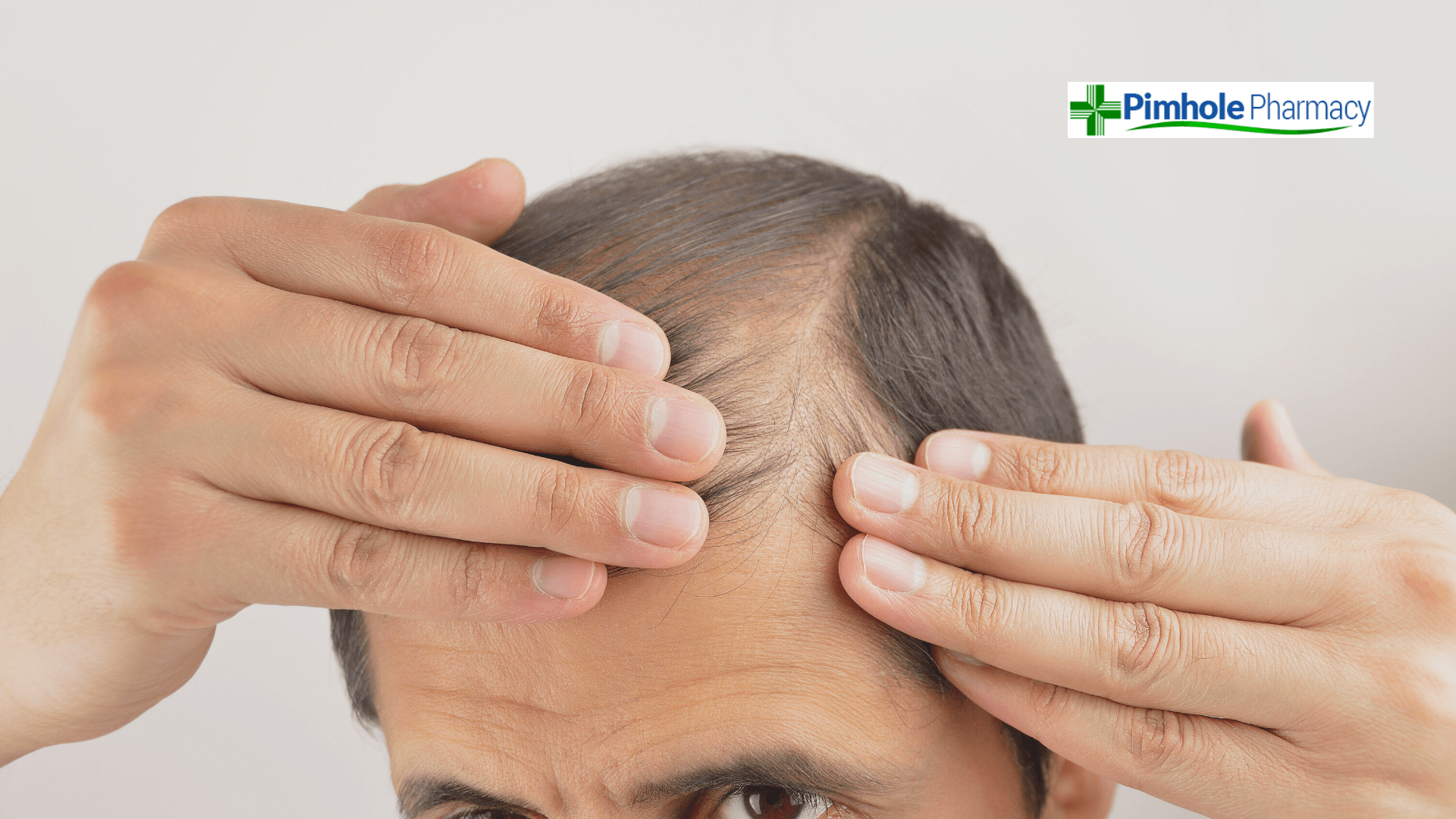 Male Hair Loss Treatments from Pimhole Pharmacy