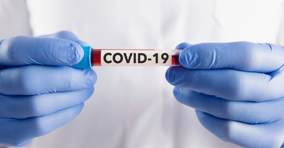 covid antibody test in Bury